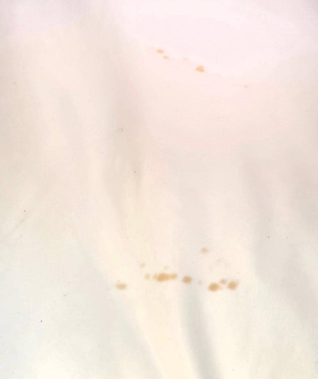 Stains in bed