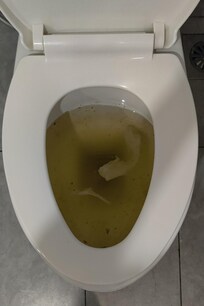 Clogged toilet