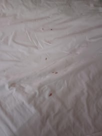 Blood stain sheets ... from prior guest...
