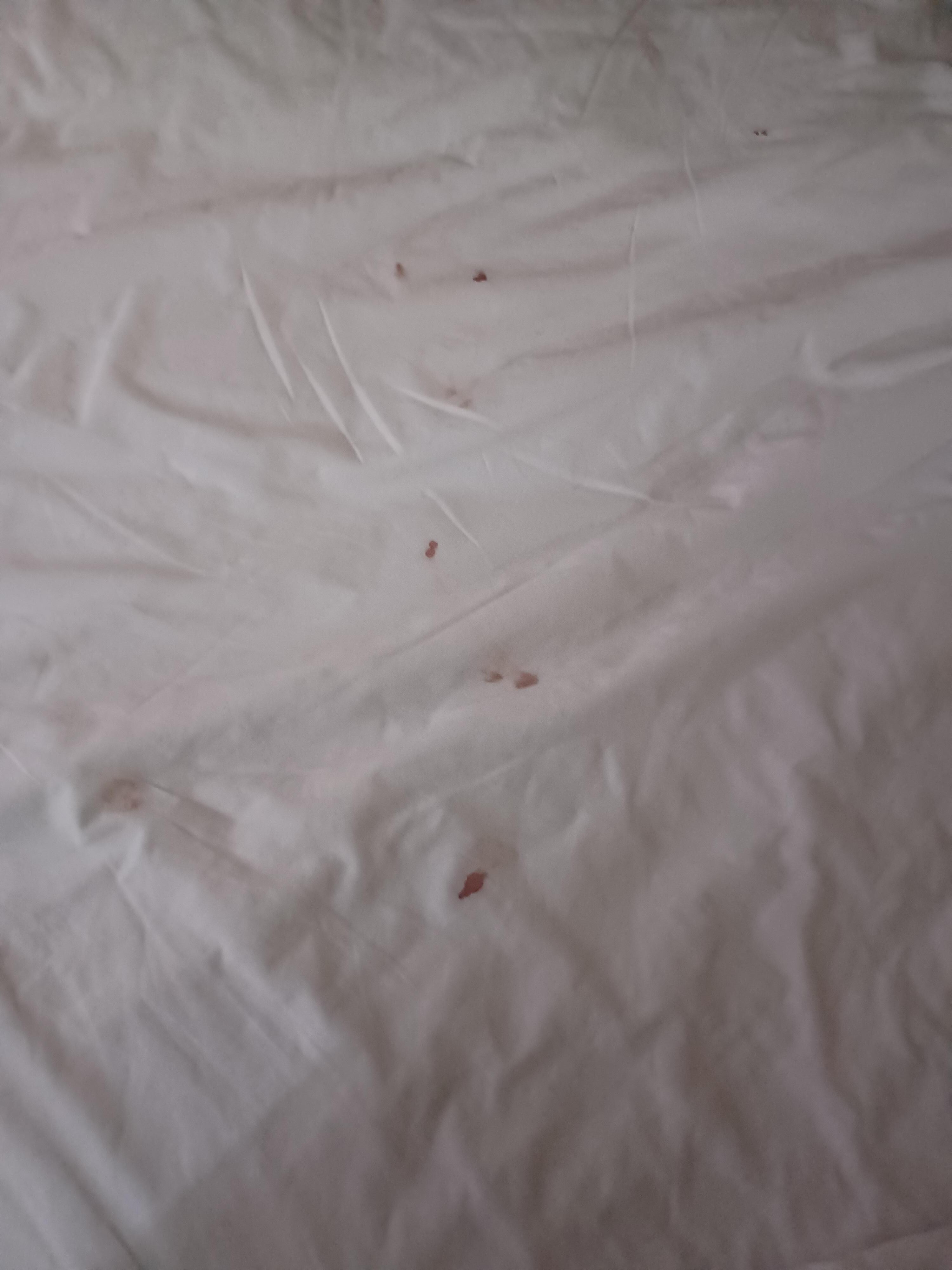 Blood stain sheets ... from prior guest... 