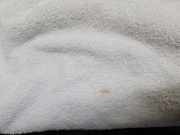 Blood stains on towel. Albeit its small, it's not mine and gross.
