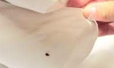 BES BUGS