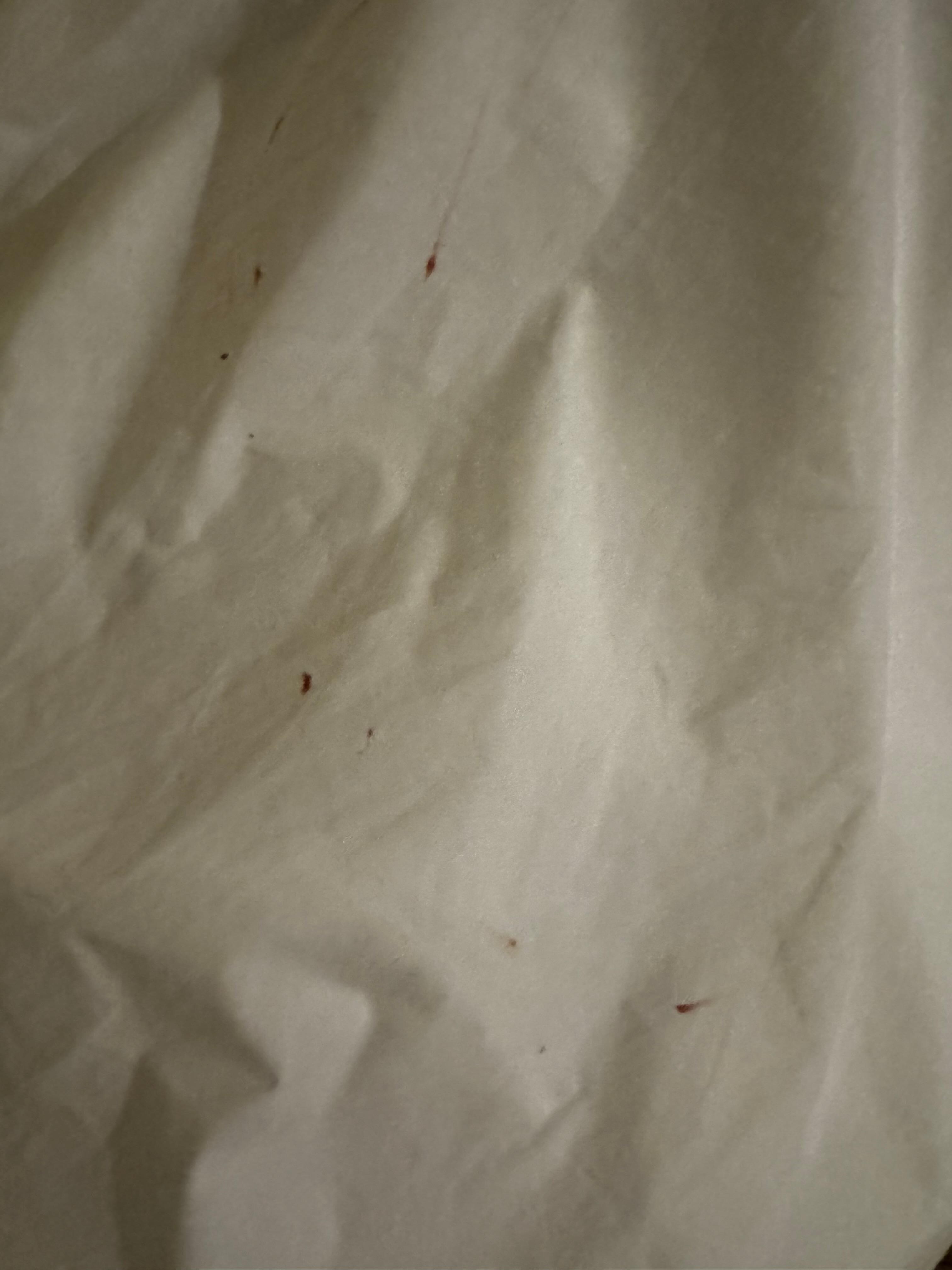 Possible bedbug spots?