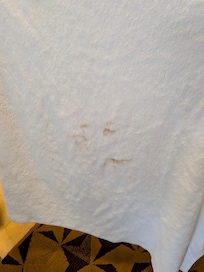 Towels has stain it looks dirty.