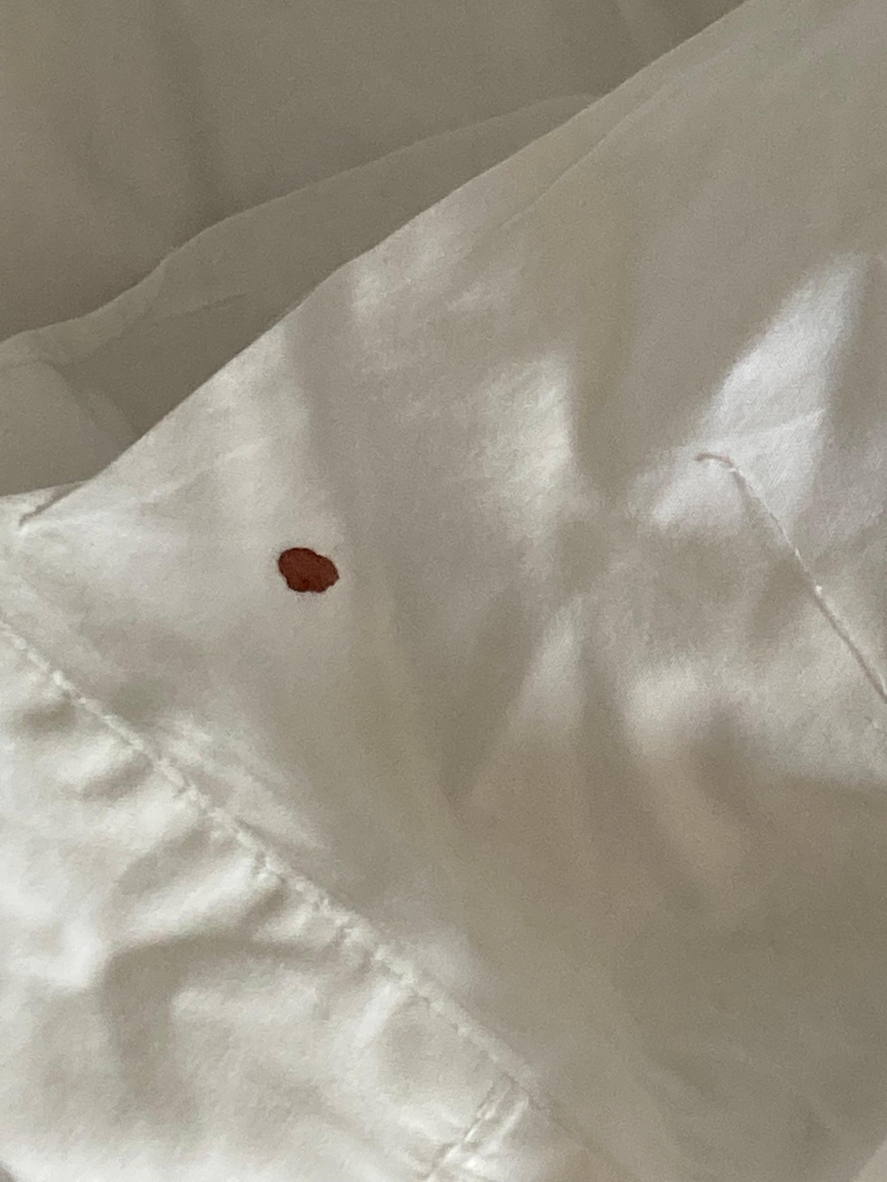 Blood (?) stain on pillowcase