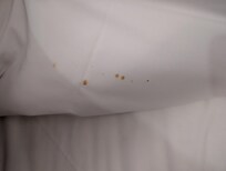 Pflecken auf der Bettwäsche