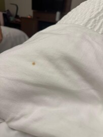 Bed 1