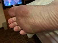 One foot. You can see the toes are clean.