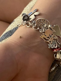 Killed gnat on my friend's wrist
