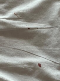 Bloodstain sheets. I didn’t notice until I woke up in the morning. We are still very mentally disturbed by this!!!