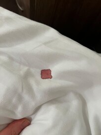 Blood on bed sheet