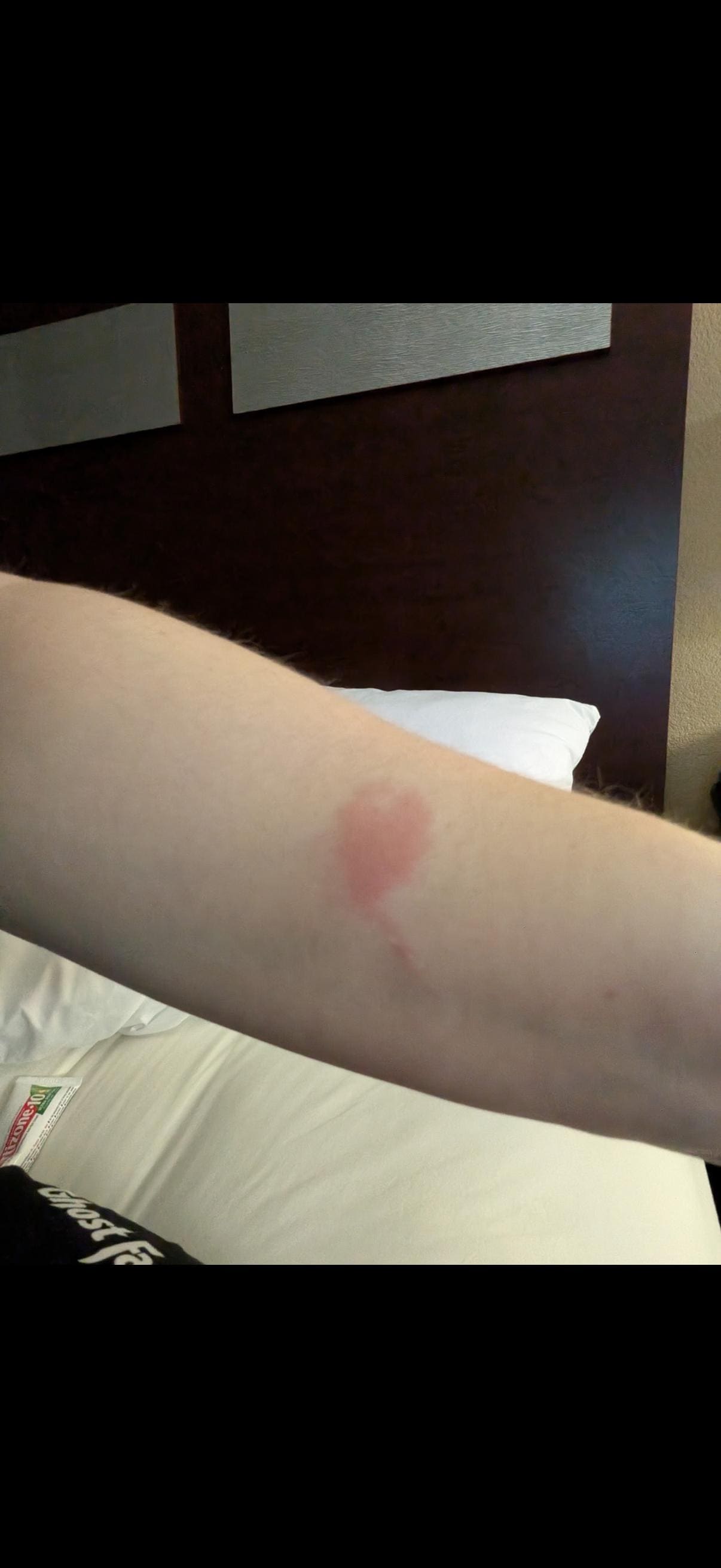 Bed bugs