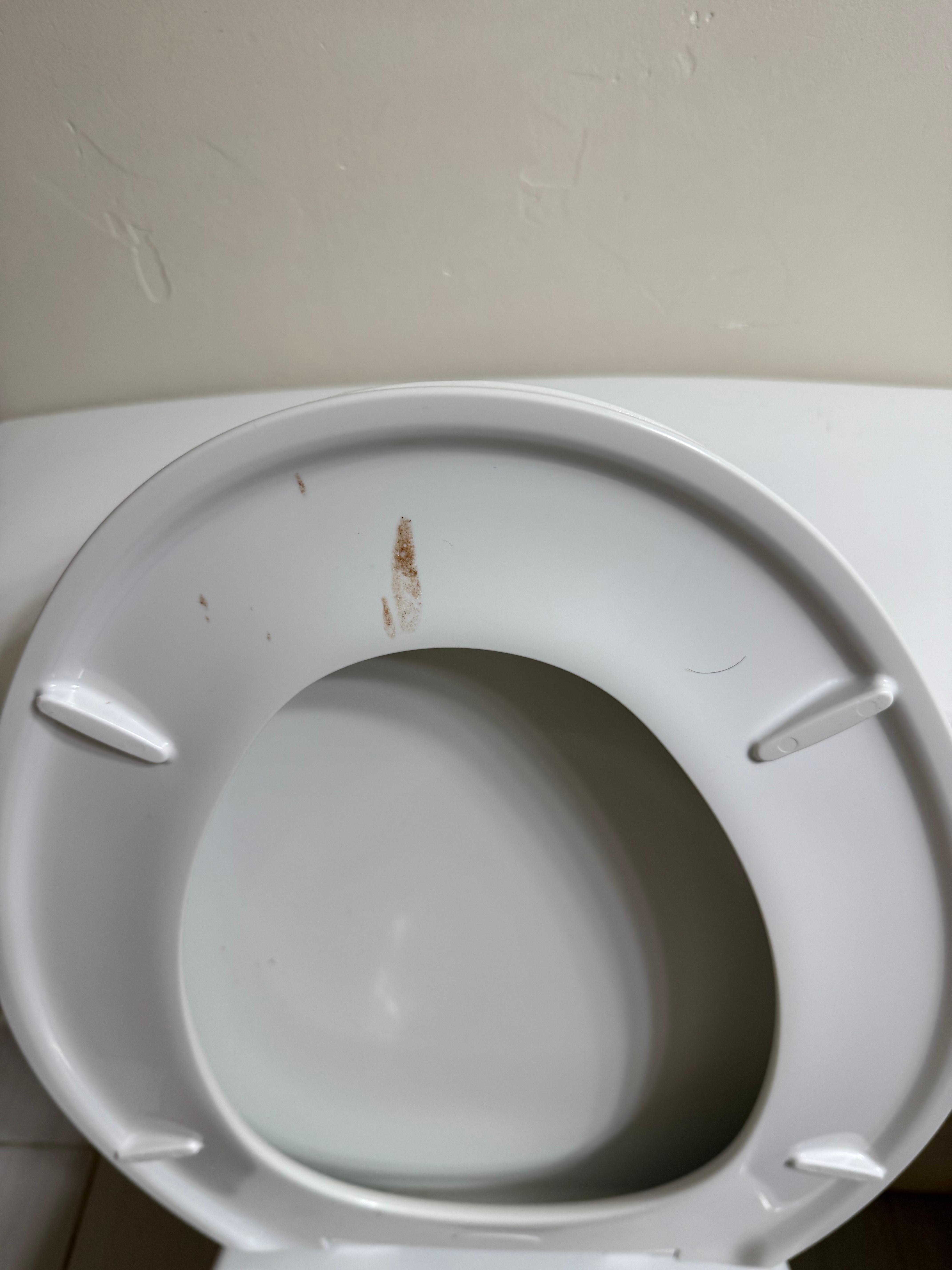 la tapa del inodoro estaba manchada con sangre, también conseguí pelos en la bañera