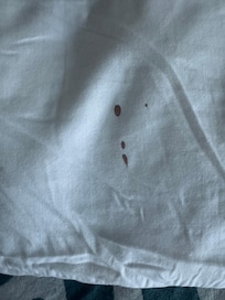Blood on the pillow!