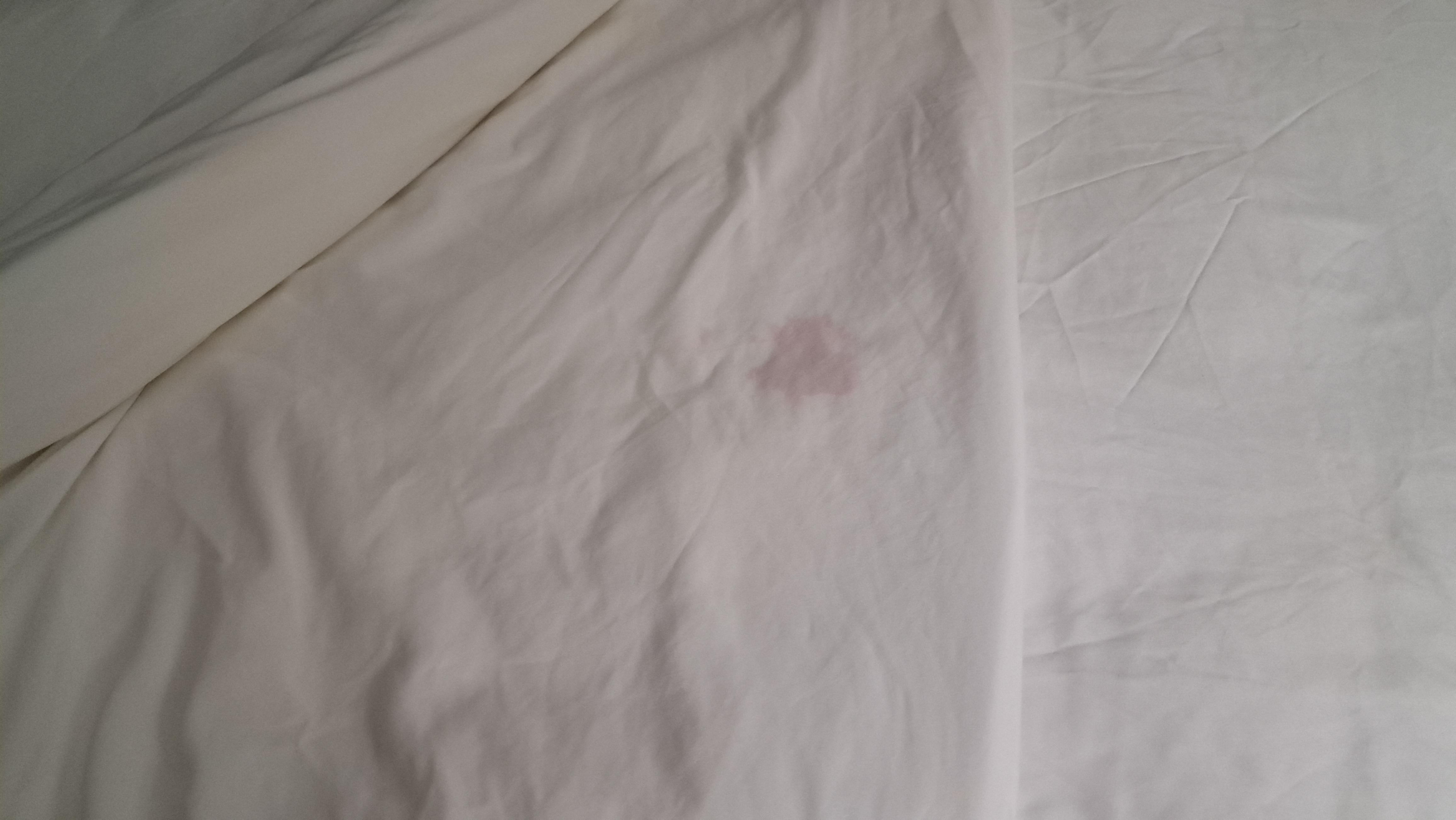 Spot remover needed!