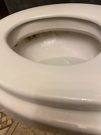 Mold under toilet rim