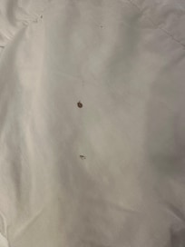 Blood stain