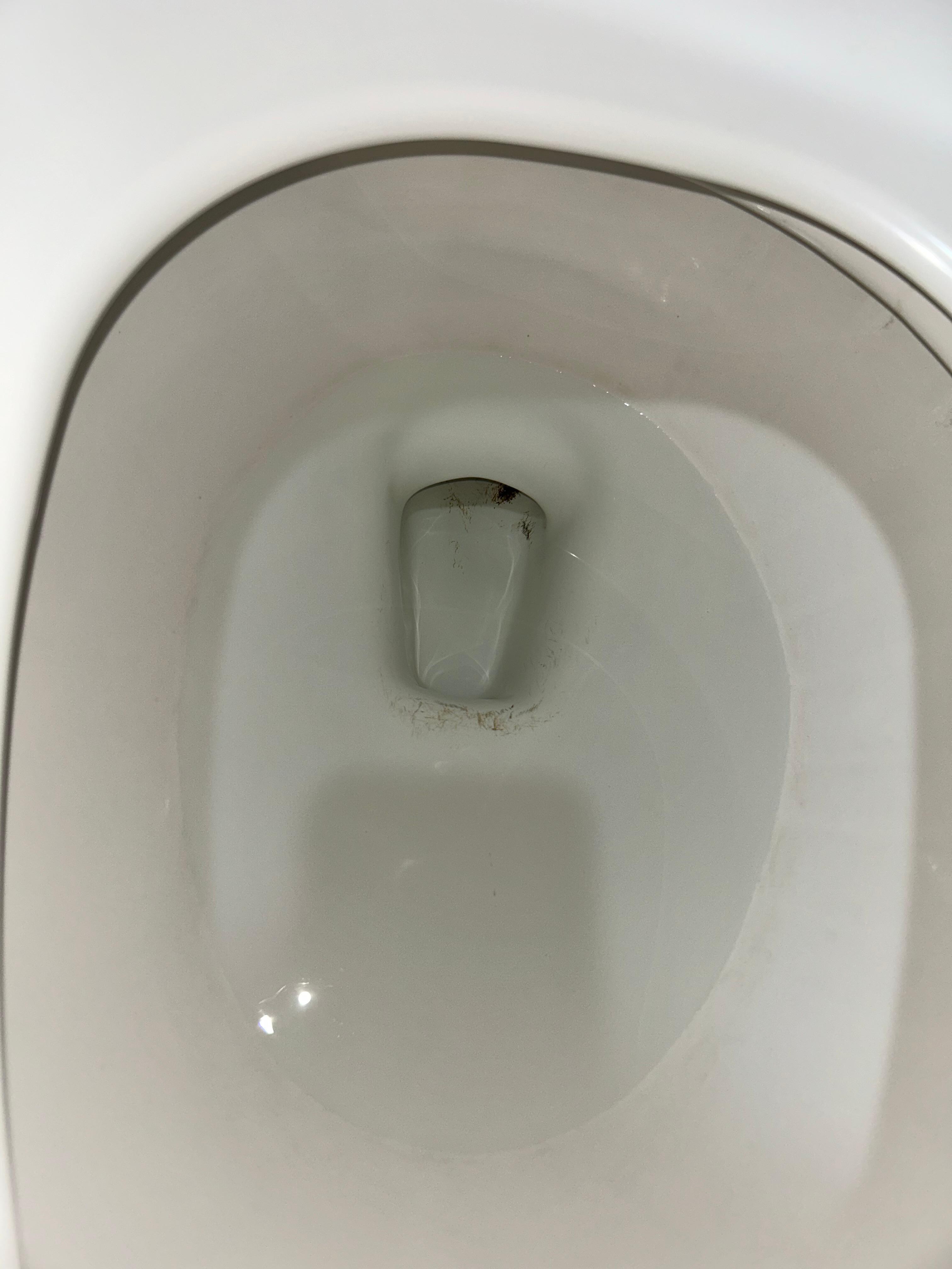 Dirty toilet bowl. 