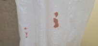 Stains on the shower curtains.