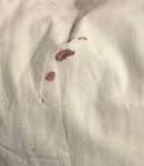 Dried blood on bedding