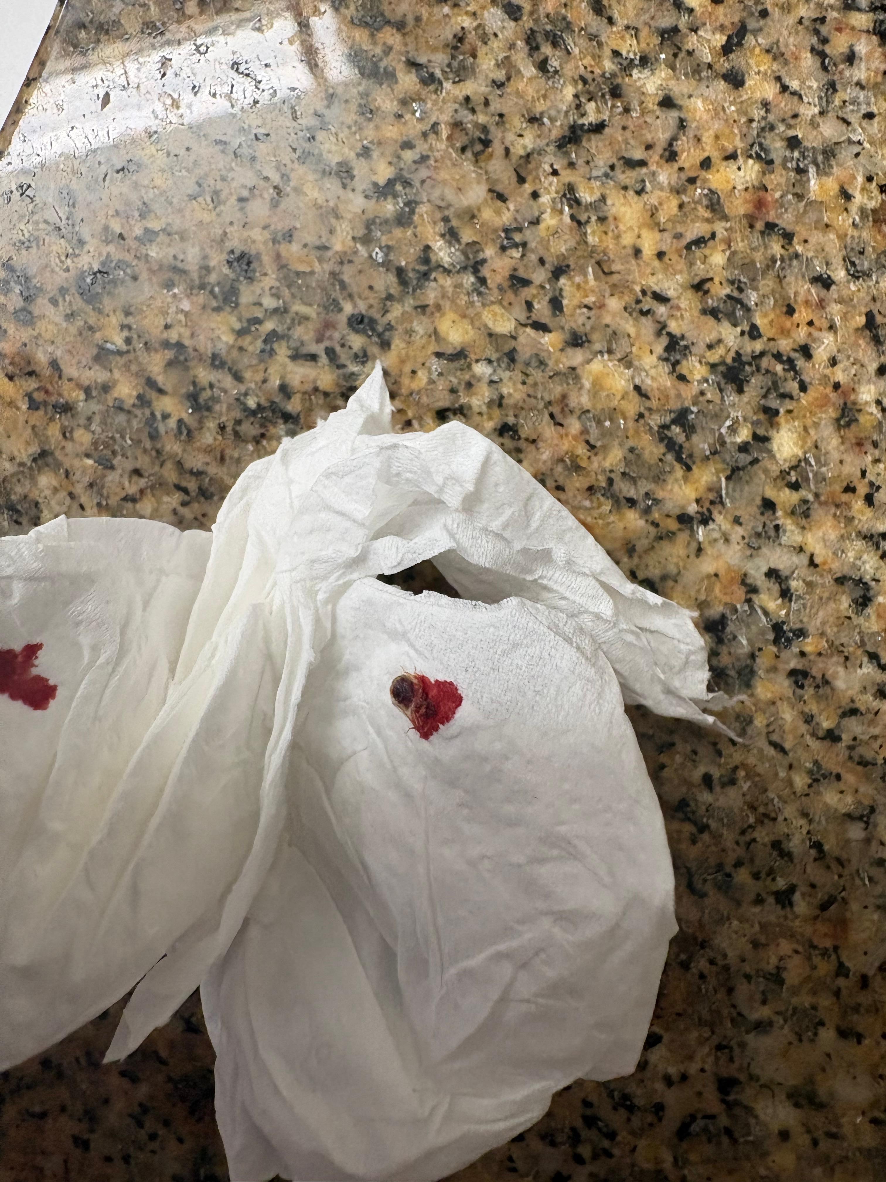 The bug after I killed it and took it to the front desk 