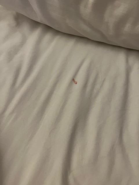 Blood on the sheet