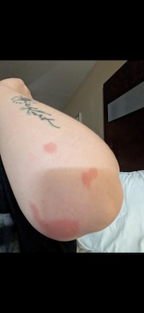 Bed bugs