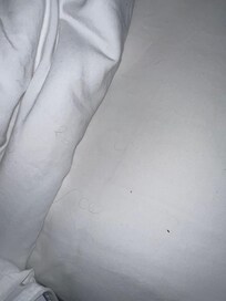 Multiple little black hairs