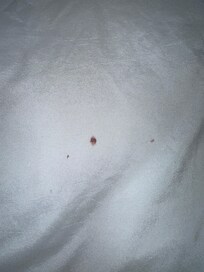 Blood stains