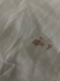 Stained sheets