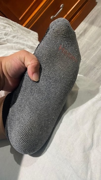 Another image of underneath my socks.