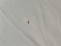 Tick #2