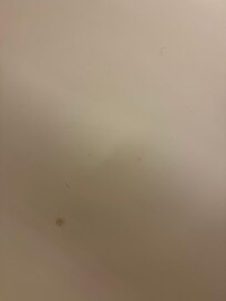 Little hairs in shower