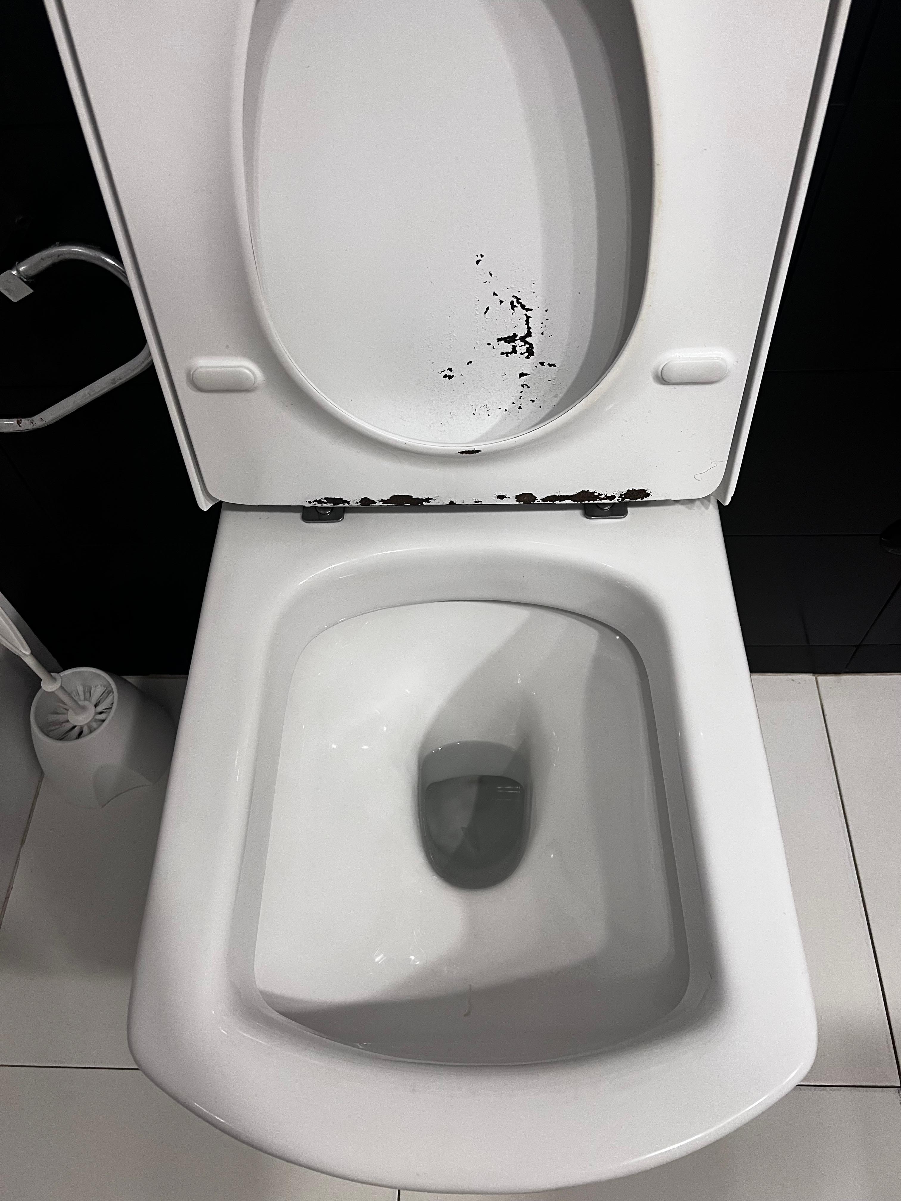 Toilet seat definitely needs replacing- looks disgusting!!!