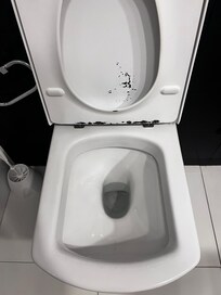 Toilet seat definitely needs replacing- looks disgusting!!!