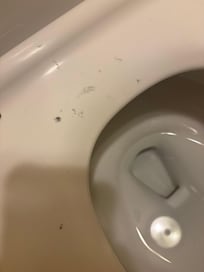 Dirty toilet seat