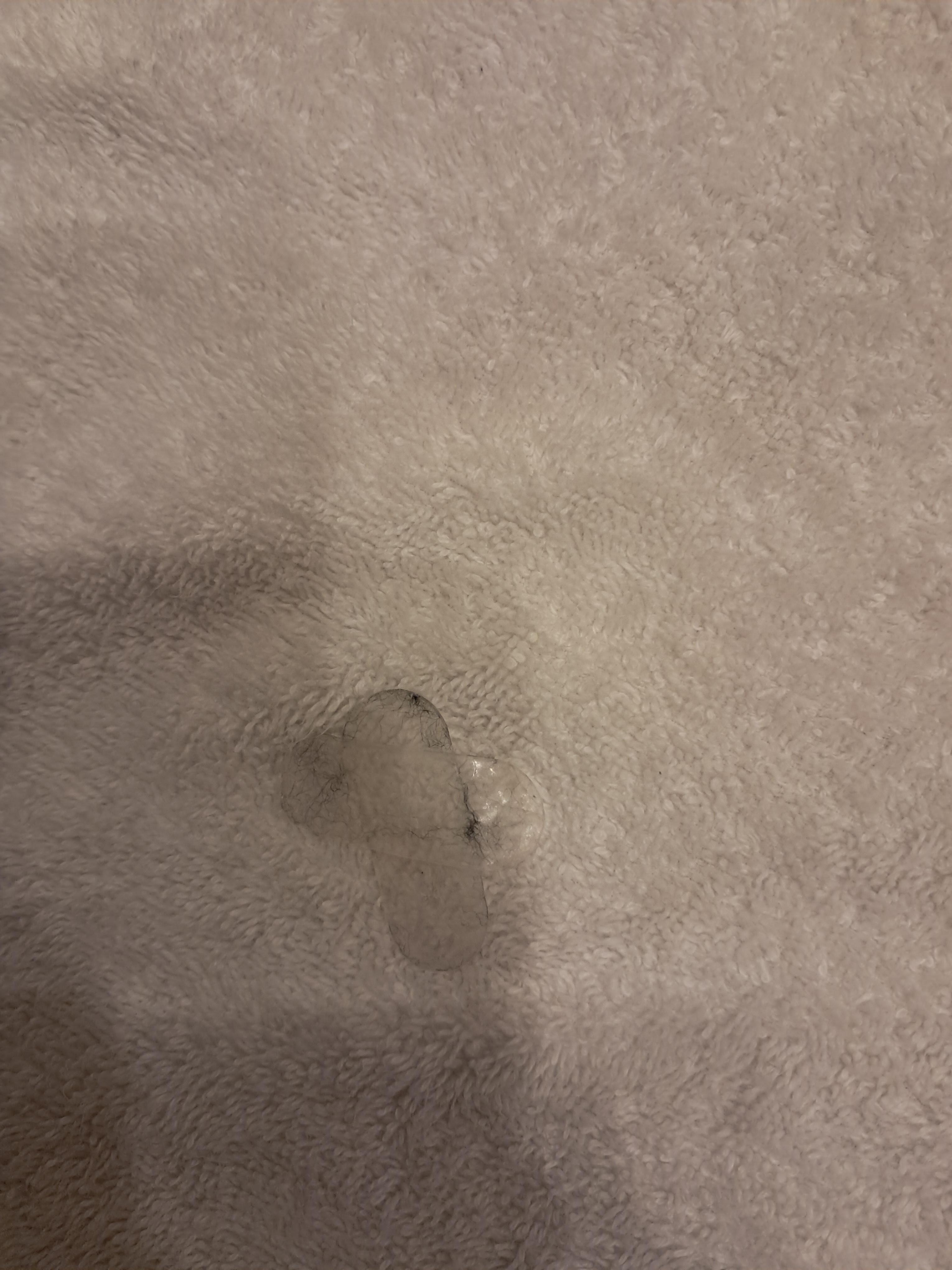 Plasters stuck to towel