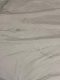 Blood stain on sheets