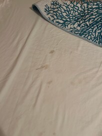 Stained bed sheets