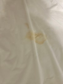 Yellow stains on kids sheets.