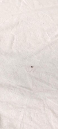 Throughout the bed there were these hair and fluff strands.