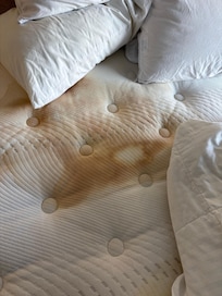 Huge stains on both beds