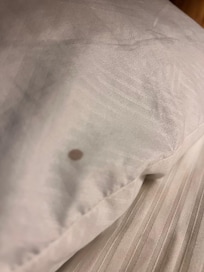 Blood and sweat rings