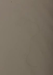 Human hair in our bed