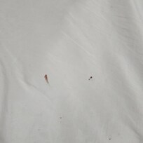 Stains on the bedding