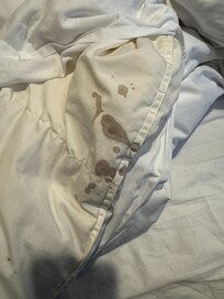 Old blood stained sheet