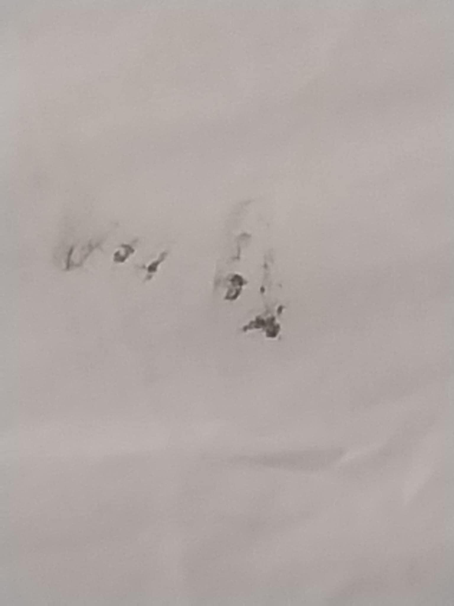 Closer look at stain or dirt mark on linens.