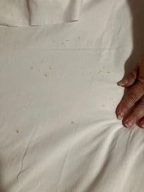stains on bed sheet