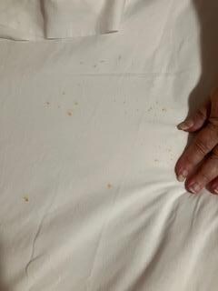 stains on bed sheet