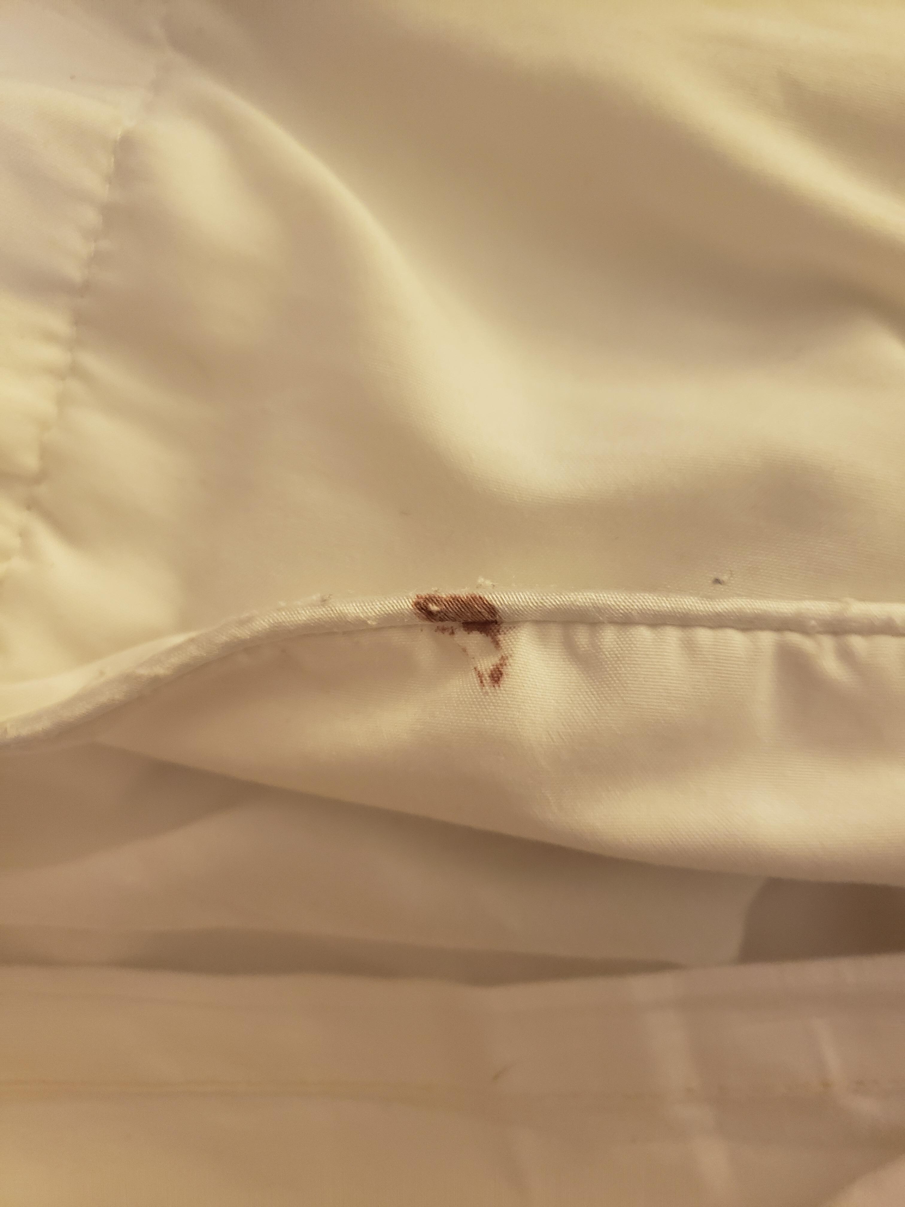 Blood on sheet?